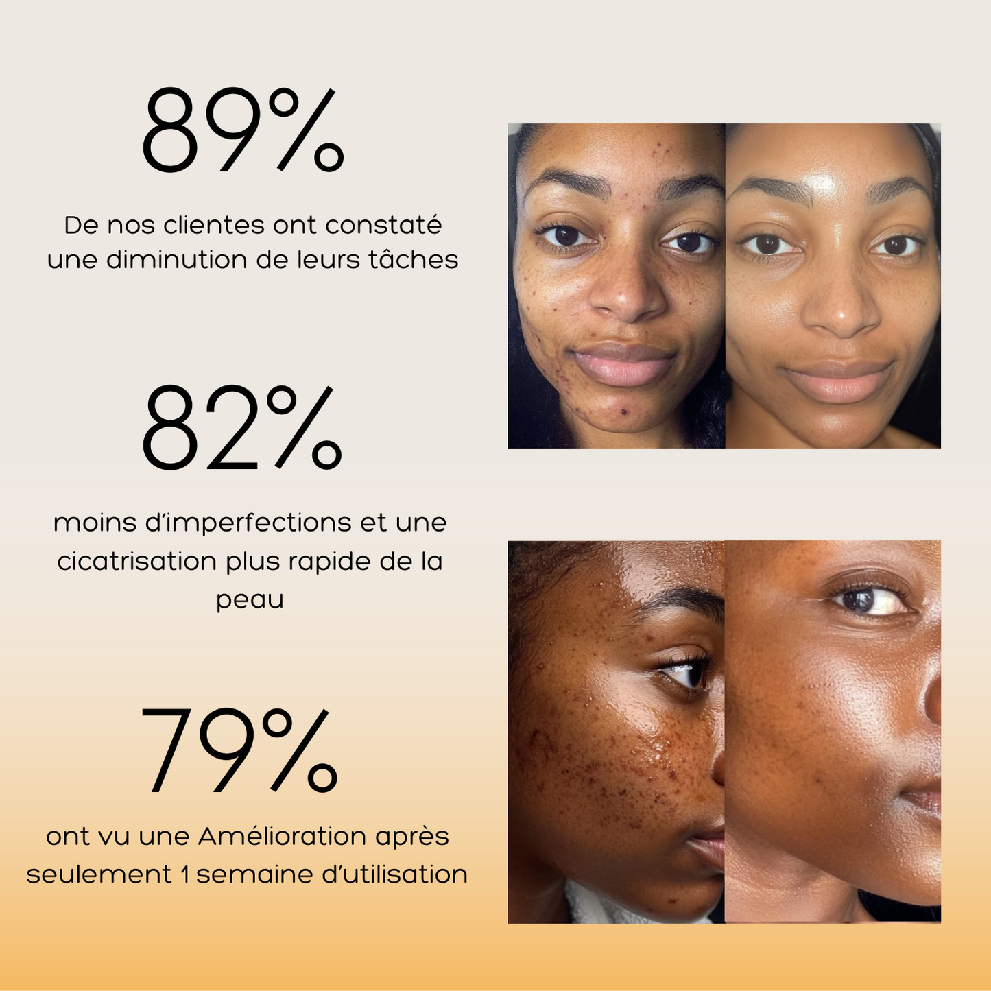 Routine Anti-Imperfections 4 en 1 - Curcula