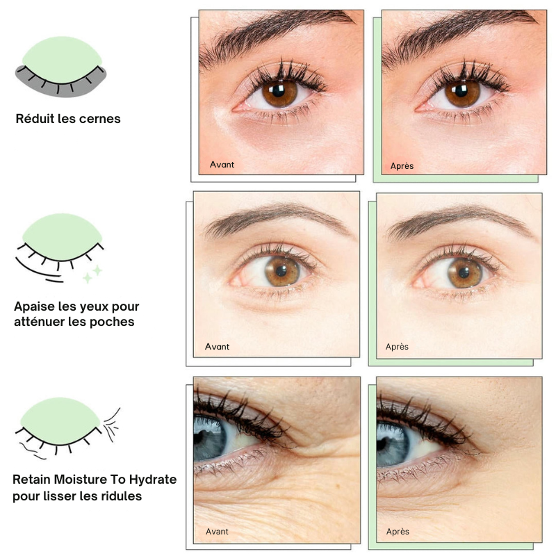 Patchs au collagène pour le contour des yeux