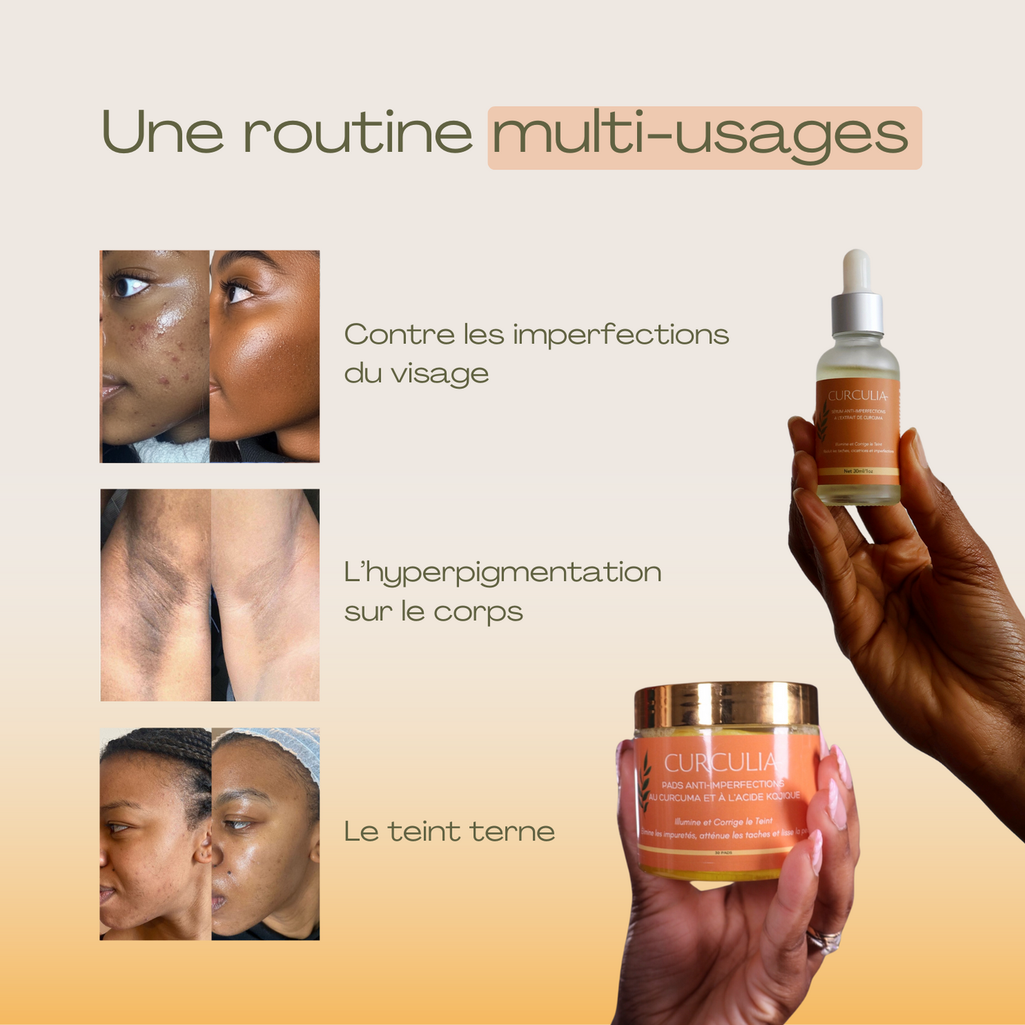 Routine Anti-Imperfections 4 en 1 - Curcula
