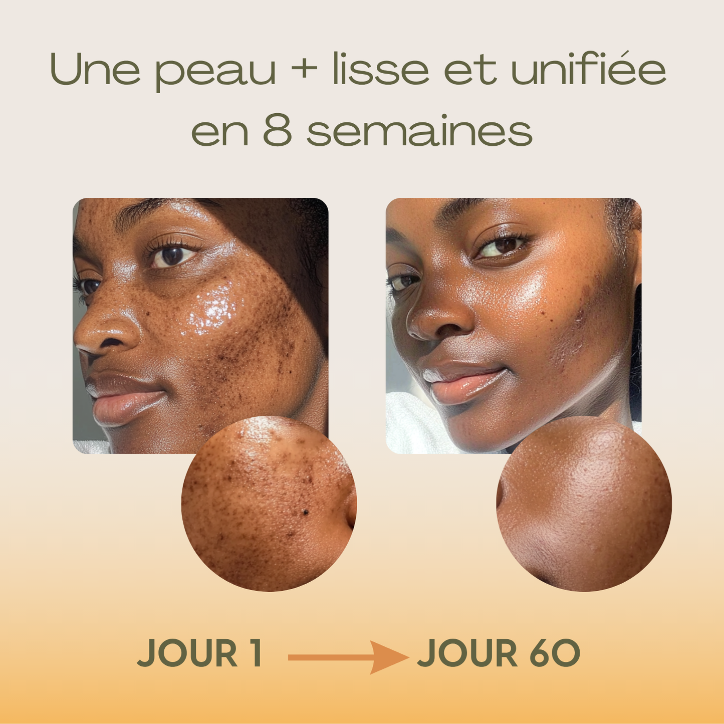 Routine Anti-Imperfections 4 en 1 - Curcula