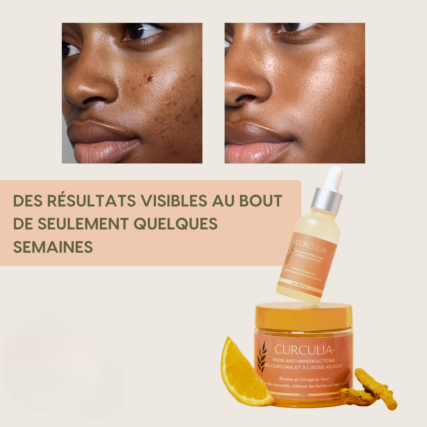 Routine Anti-Imperfections 4 en 1 - Curcula